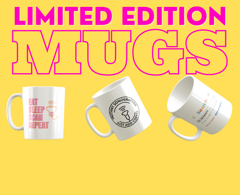 Limited edition coffee mugs: Available NOW!